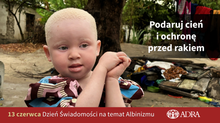 Międzynarodowy Dzień Świadomości na temat Albinizmu – 13 czerwca